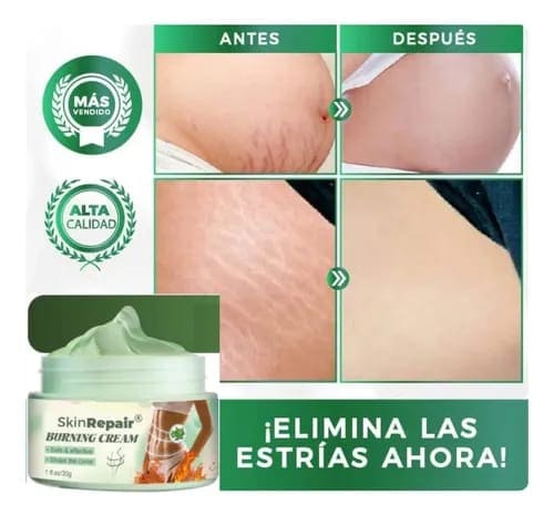 Crema Súper Antiestrias