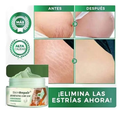 Crema Súper Antiestrias